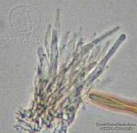 GPHA0173 Vermicularopsiella inmersa.jpg