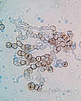 ME008 0071 Aureobasidium.jpg