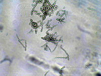ME008 0120 Cladosporium.jpg