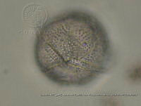 ZME y MEMC-LFMS075 Protoceratium spinulosum.JPG