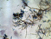 ME008 0118 Cladosporium.jpg