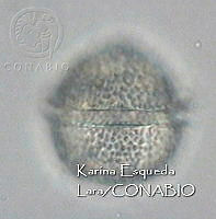 KEL0338 Protoceratium reticulatum.JPG
