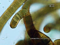 KT016 0033 Ophiothrix sp..jpg