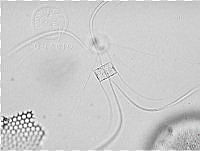 DUHB0088 Chaetoceros didymus.png