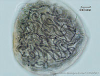 UNAMGAMZ-48 Nostoc verrucosum.jpg