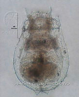 HE009 R 0126 Brachionus calyciflorus.jpg