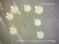 AAVA002 Pantoea agglomerans.jpg