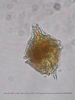 ZME y MEMC-LFMS103 Gonyaulax polygramma.JPG