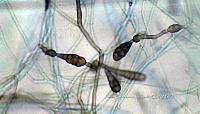 ME008 0016 Alternaria spp..jpg