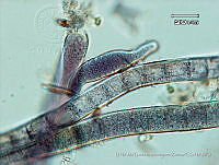 KT018 0033 Brasilonema tolantongensis.jpg