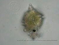 ZME y MEMC-LFMS019 Gonyaulax turbynei.JPG