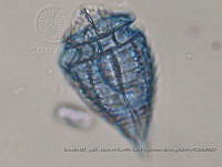 ZME y MEMC-LFMS294 Corythodinium tesselatum.JPG