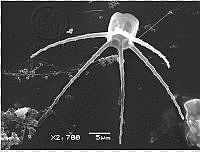 DUHB0072 Chaetoceros compressus.png