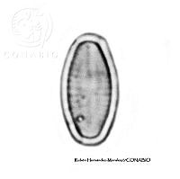 NE002 0017 Achnanthes minutissima.jpg