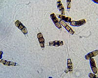 ME008 0382 Torpedospora spp..jpg