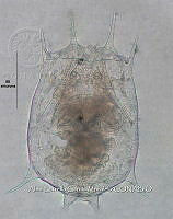 HE009 R 0081 Brachionus calyciflorus.jpg