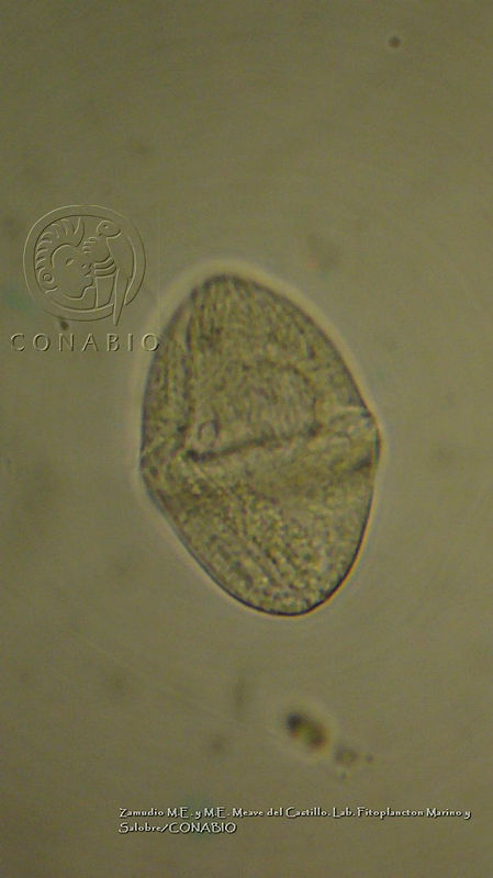 ZME%20y%20MEMC LFMS135%20Gymnodinium%20rhomboides.JPG.jCfnwYP0MYeJF3thQA3g0JtbmFja29CbnFuZ3NAbXJ6LGtwZwA.lzCSb0r3y4