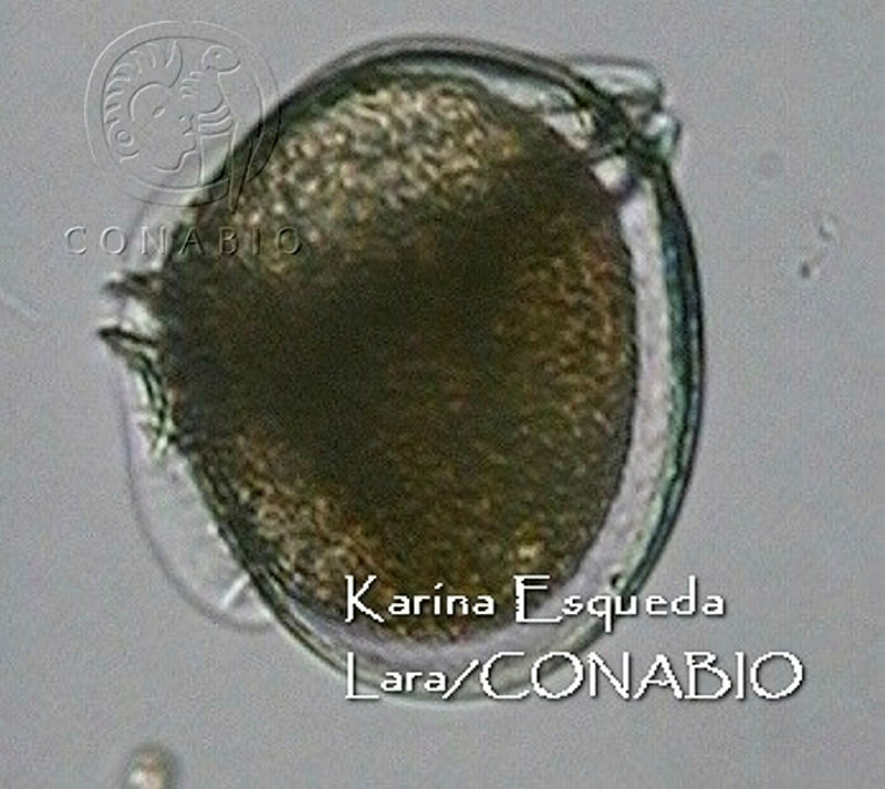 KEL0083%20Dinophysis%20argus.JPG.jCfji4v0MR0zuYNhQA3g0JtbmFja29CbnFuZ3NAbXJ6LGtwZwA.D1qTch1rfr