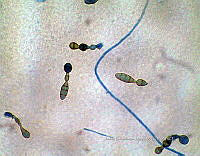 ME008 0024 Alternaria spp..jpg