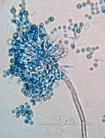 ME008 0065 Aspergillus.jpg