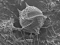 ZME y MEMC-LFMS282 Heterodinium milneri.JPG