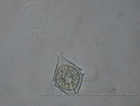 ZME y MEMC-LFMS207 Gonyaulax verior.JPG