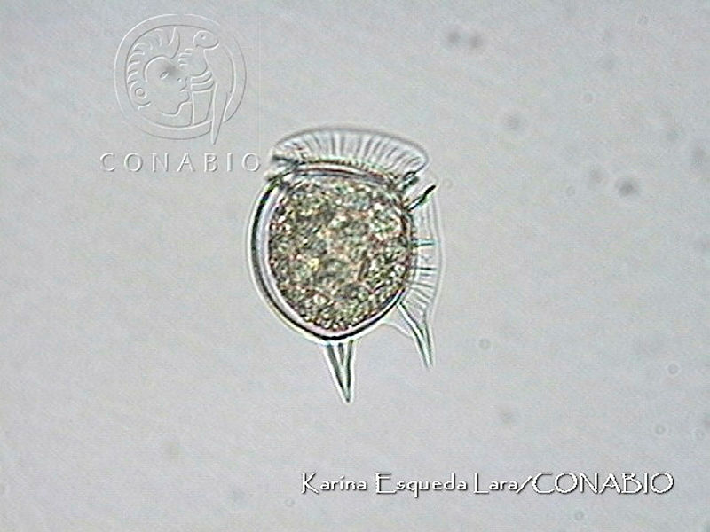 KEL0095%20Dinophysis%20conjuncta.JPG.jCfvuYv0MeXR2e9fQA3g0JtbmFja29CbnFuZ3NAbXJ6LGtwZwA.h0RPQVV4Py