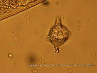 ZME y MEMC-LFMS007 Gonyaulax birostris.JPG