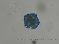ZME y MEMC-LFMS021 Lingulodinium polyedra.JPG