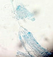 ME008 0170 Isaria spp..jpg