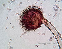 ME008 0152 Eurotium.jpg