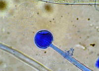 ME008 0068 Aspergillus.jpg