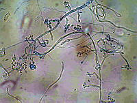 ME008 0293 Phoma.jpg