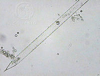 DUHByJSP0034 Rhizosolenia clevei.png