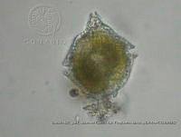ZME y MEMC-LFMS018 Gonyaulax turbynei.JPG
