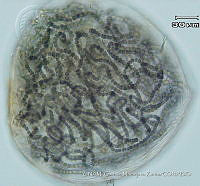 KT018 0199 Nostoc verrucosum.jpg