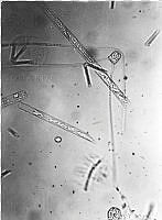 DUHB0095 Chaetoceros peruvianus.png