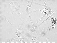 DUHB0094 Chaetoceros peruvianus.png