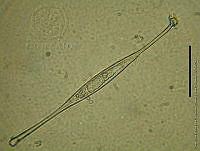 DJ017-4 Amphisolenia globifera.jpg