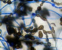 ME008 0020 Alternaria spp..jpg