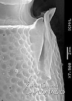 KEL0288 Phalacroma oxytoxoides.JPG
