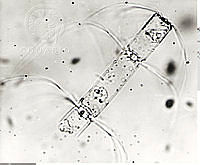 DUHB0040 Bacteriastrum comosum.png