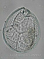 KEL0239 Ostreopsis siamensis.JPG