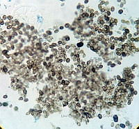 ME008 0075 Bispora.jpg