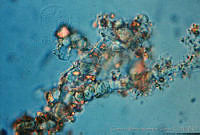 UNAMGAMZ-41 Hyella sp..jpg