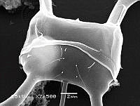 DUHB0083 Chaetoceros dichaeta.png