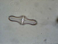 UNAMECU-1 Achnanthes inflata var. inflata.jpg