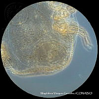 MVG 0672 Uropodina.JPG