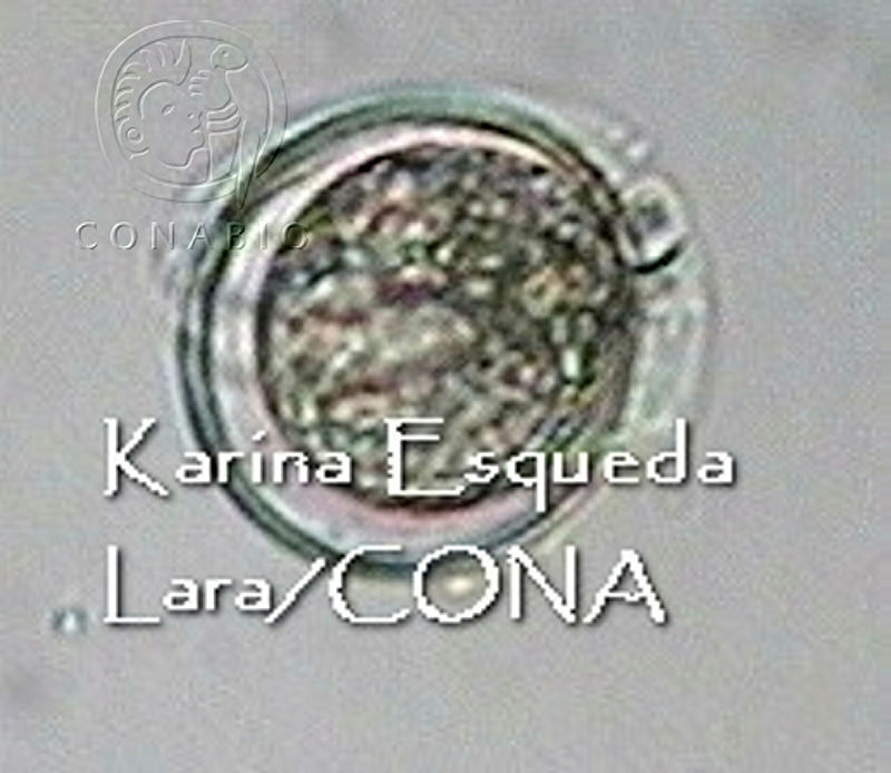 KEL0110%20Dinophysis%20laevis.JPG.jCeptYf0MeFNwYNhQA3g0JtbmFja29CbnFuZ3NAbXJ6LGtwZwA. EzXo3Glcc