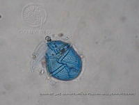 ZME y MEMC-LFMS261 Gonyaulax hyalina.JPG